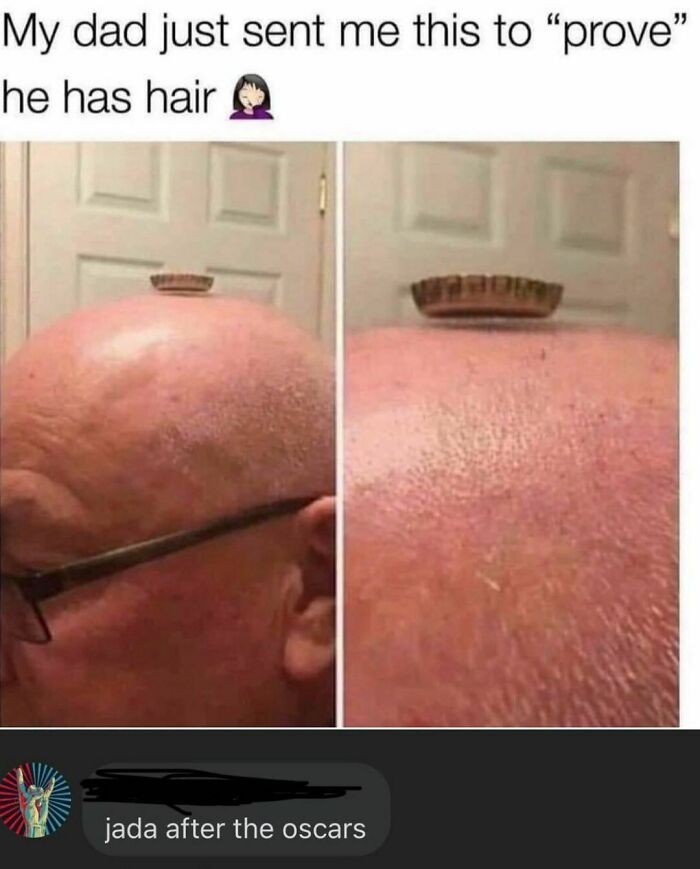 27. He does have hair