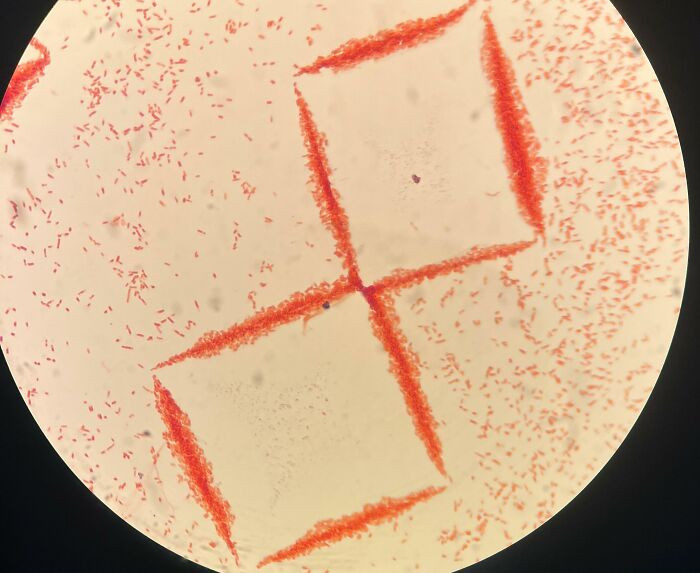 "Interesting Arrangements Of E. Coli Under Microscope"
