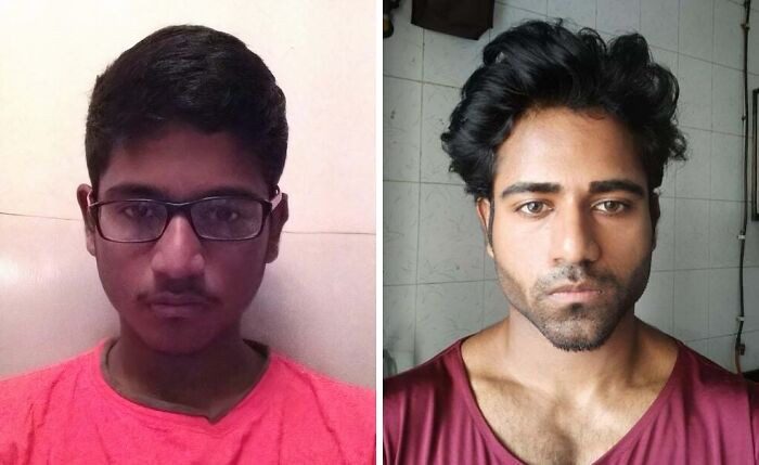 "Small Changes Over Time. Age 16 To 24. Given Enough Hard Work And Patience, There Is Hope. I Hope This Motivates You To Glow Up Into Your Best Version"