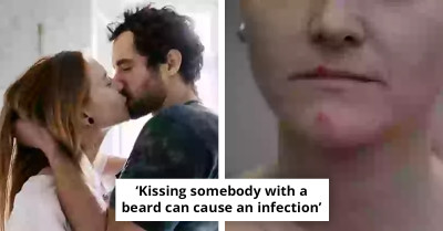 Doctor Reveals Risky Side Of Kissing Men With Beards