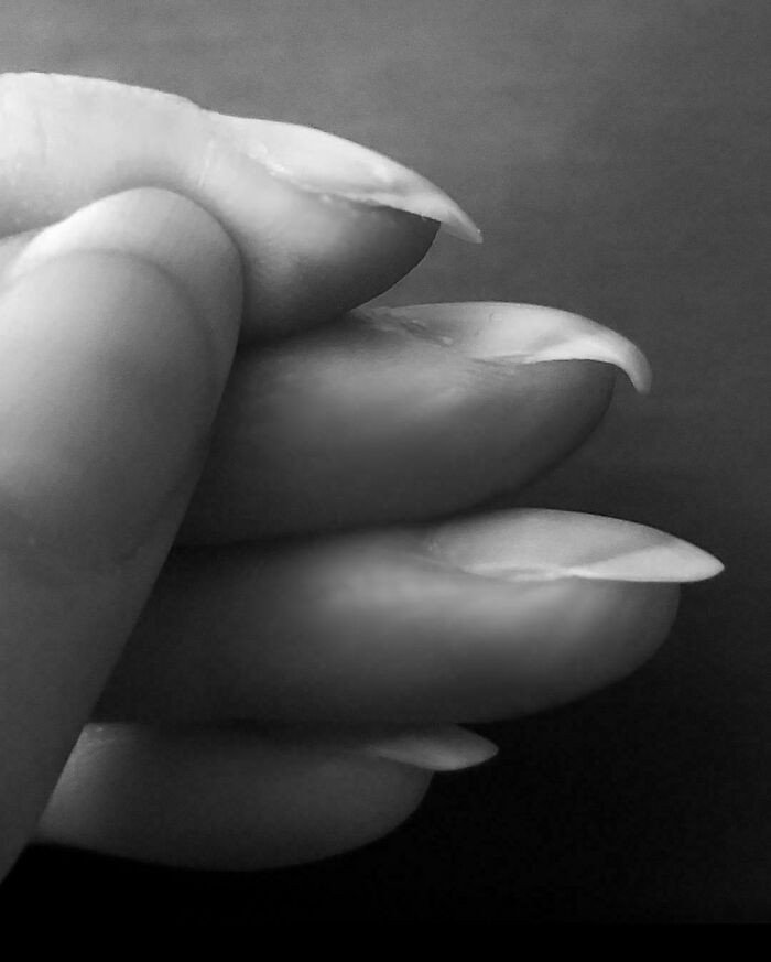 "My Middle Finger Nails Have Always Curled More Than My Other Nails"