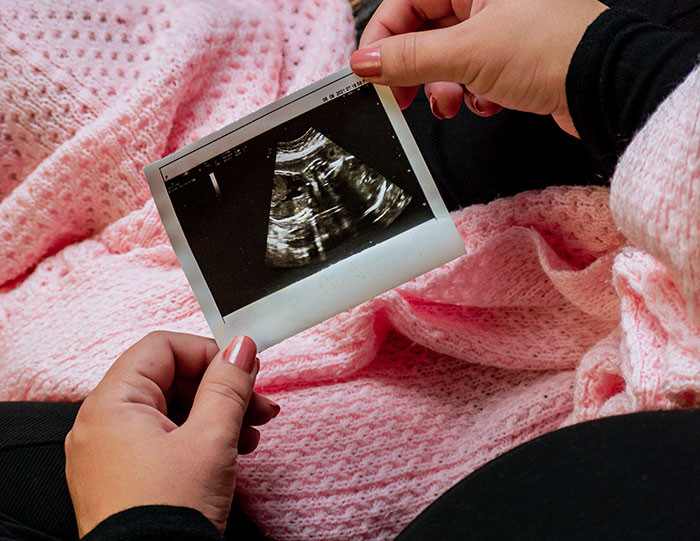3. Her sister took over her wedding day... And a cabin for the wedding night