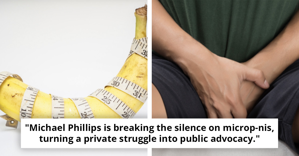 Understanding Micropenises: Man Opens Up About Living with the 'World's Smallest' and Its Effects