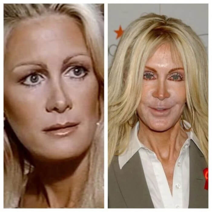 10. Joan Van Ark