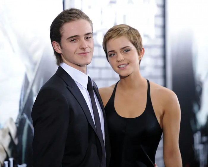 6. This is Emma Watson's brother, Alex Watson