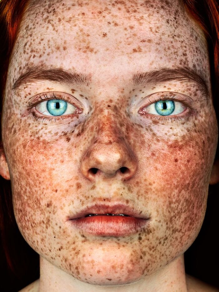 “Saxon Stableford” - Freckles