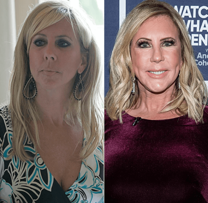 18. The “Real Housewives of Orange County” actress Vicki Gunvalson changed her appearance in 2012 after being called “Miss Piggy.”