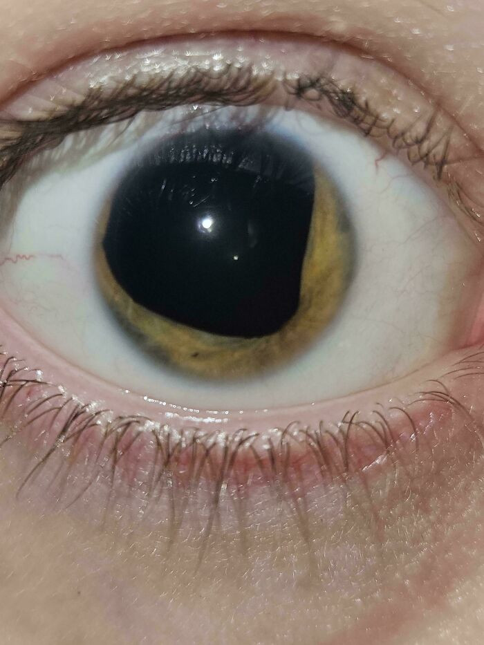 "I Have (Almost) No Eye Color"
