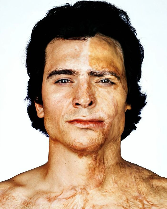 “Beau Zanca” - Scars
