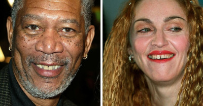 13 Celebrities Who Embraced Their Crooked Smiles In The Most Perfectly Imperfect Way