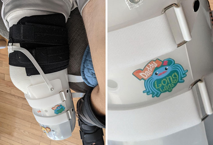 47. Just Lost My Foot After A Motorcycle Accident. This Is The Sticker My Son Chose To Decorate My Brace.