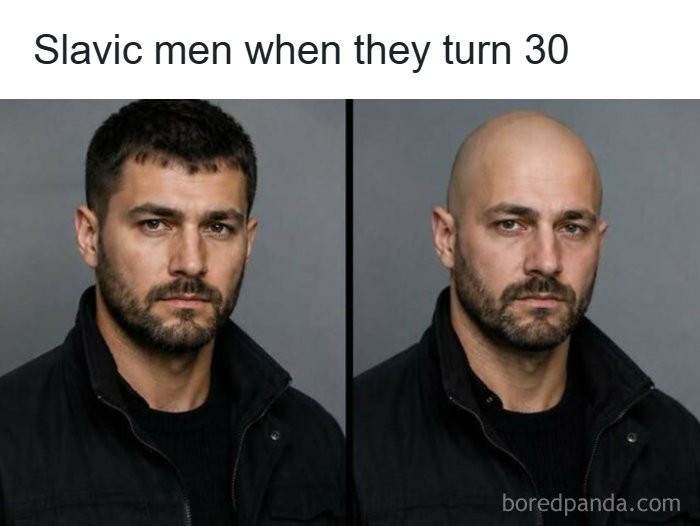 The 30th Birthday: A Magical Moment Where The Slavic Genes Decide It's Time For A New Look. Who Else Experienced This 'Upgrade' Recently?