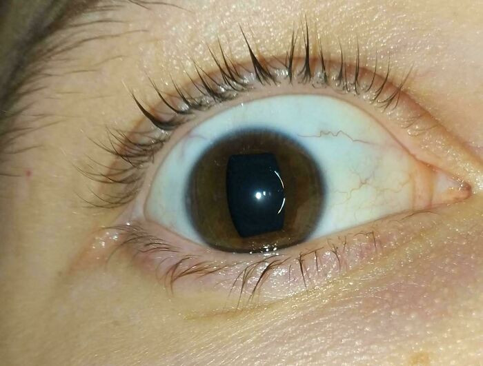 'My Pupils Are Rectangular'