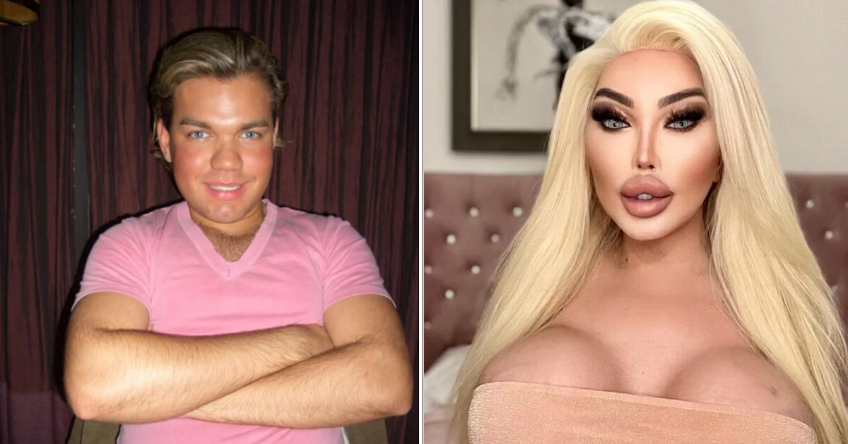 The Price Of Perfection: Inside The Extravagant Journey Of The 'Human Ken Doll'