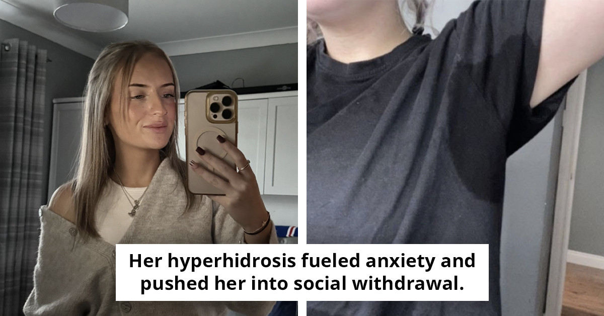 Woman with 'challenging' uncommon condition causing her to 'produce three liters of sweat daily' reveals images of her daily life