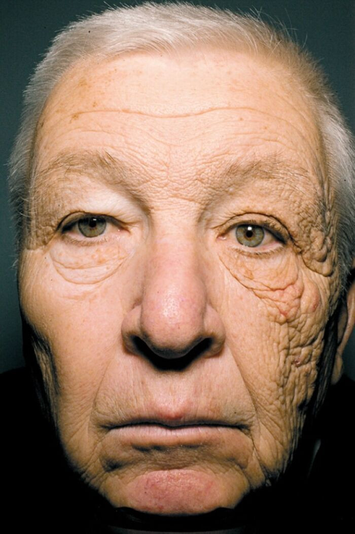 "Before And After UV Damage"