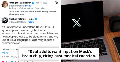 Elon Musk Sparks Debate With Neuralink Hearing Implant Idea