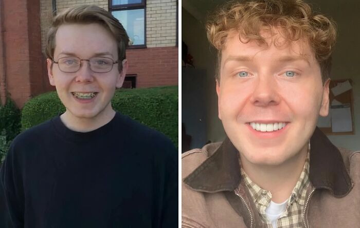 "18 vs. 28 Years Old. I’d Like To Think There Was Some Improvement"