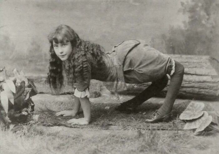 "Ella Harper, Born 1870 In Tennessee. She Had "Curved Knees" And Was A Circus Exhibit From Age 12. She Was Called "Camel Girl" And The "Most Wonderful Freak Of Nature." She Was Paid The Equivalent Of $6300 A Week"