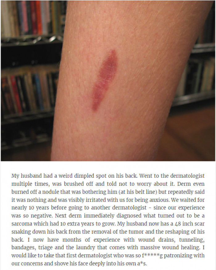 26. He has a 48 inch scar.