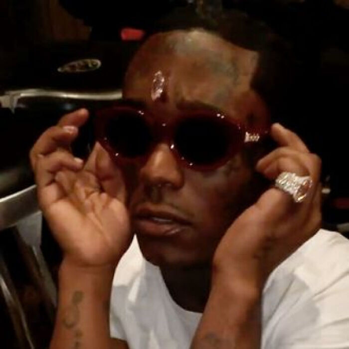 4. Lil Uzi Vert Pierced His Forehead With A $24 Million Pink Diamond
