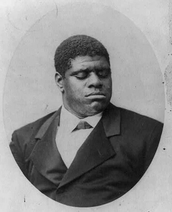 "Tom Wiggins (1849-1908) Was A Famous American Pianist, Composer, And Performer Who Was Born Blind And Had Autism"