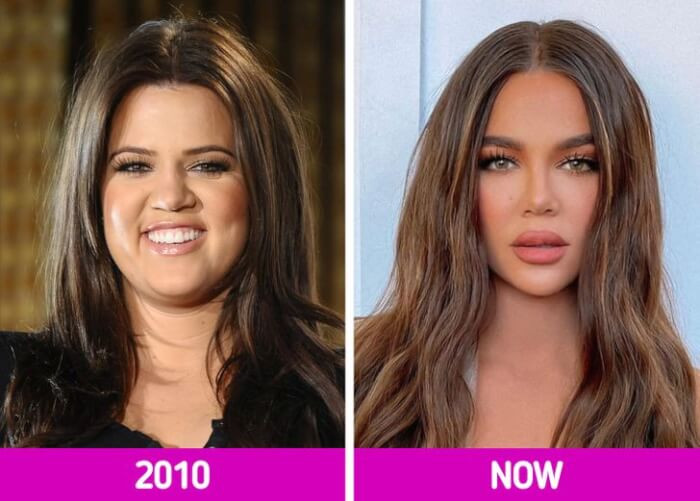 8. Khloé Kardashian has a completely new appearance, and her face is becoming thinner