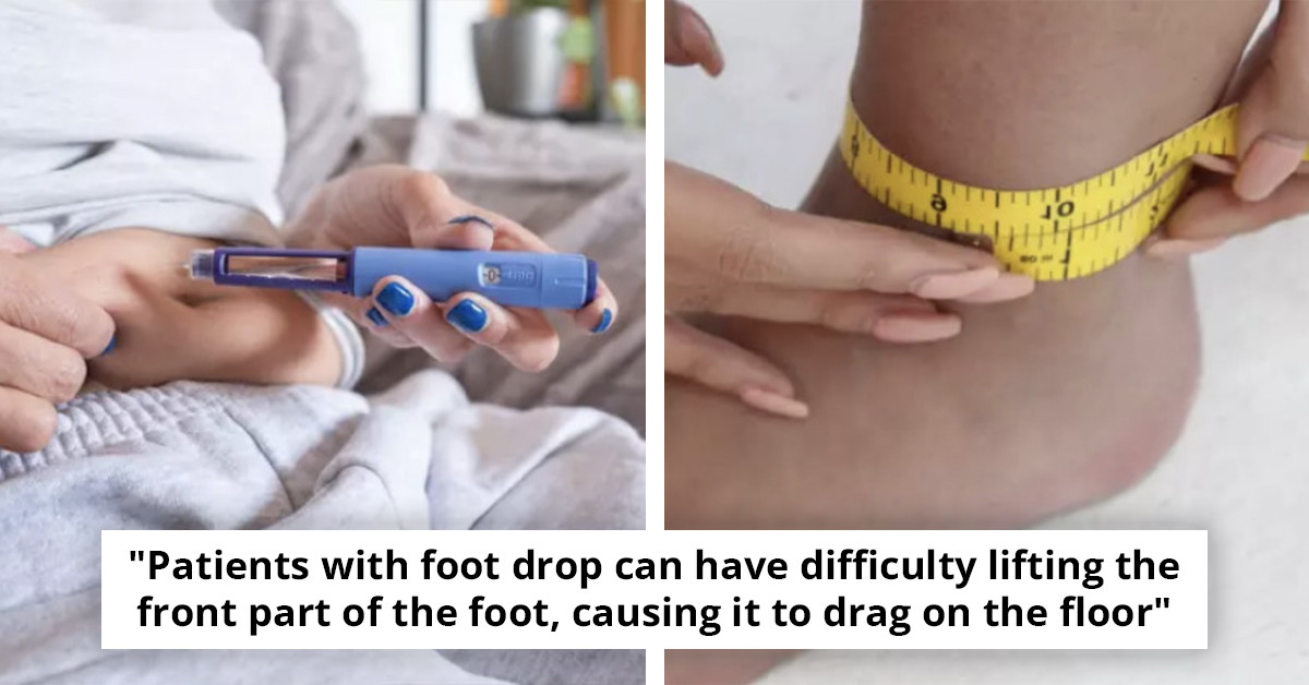 Surgeon Warns About An Unexpected Side Effect Of Using Weight Loss Medications