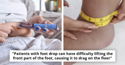 Surgeon Warns About An Unexpected Side Effect Of Using Weight Loss Medications