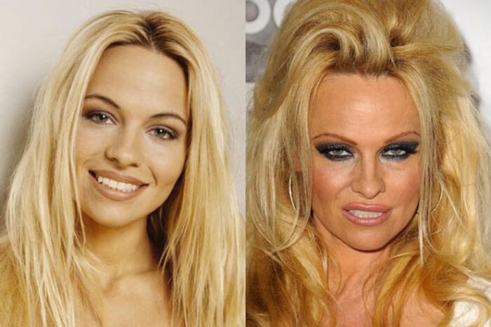 9. Pamela Anderson