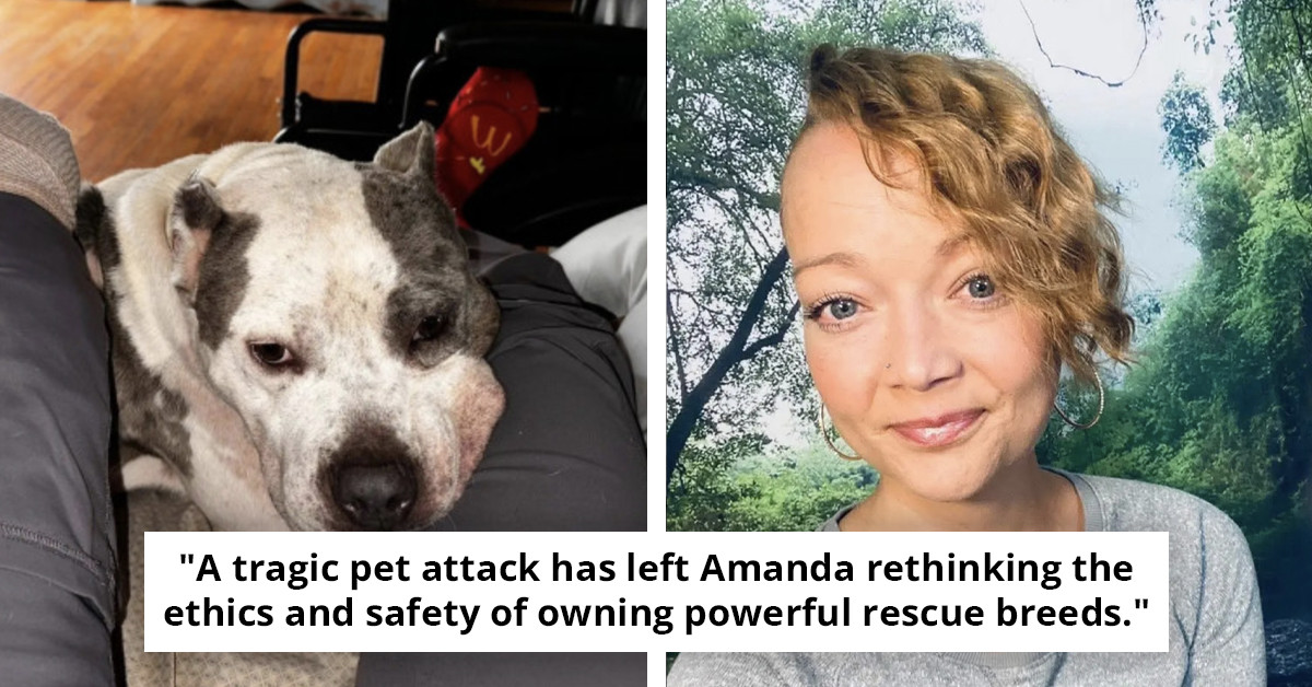 Tennessee Mother Suffers Severe Injury in Pet Pit Bull Incident Resulting in Amputation of Leg