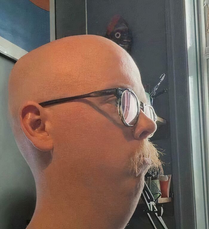 ”i Look Like A Worm”