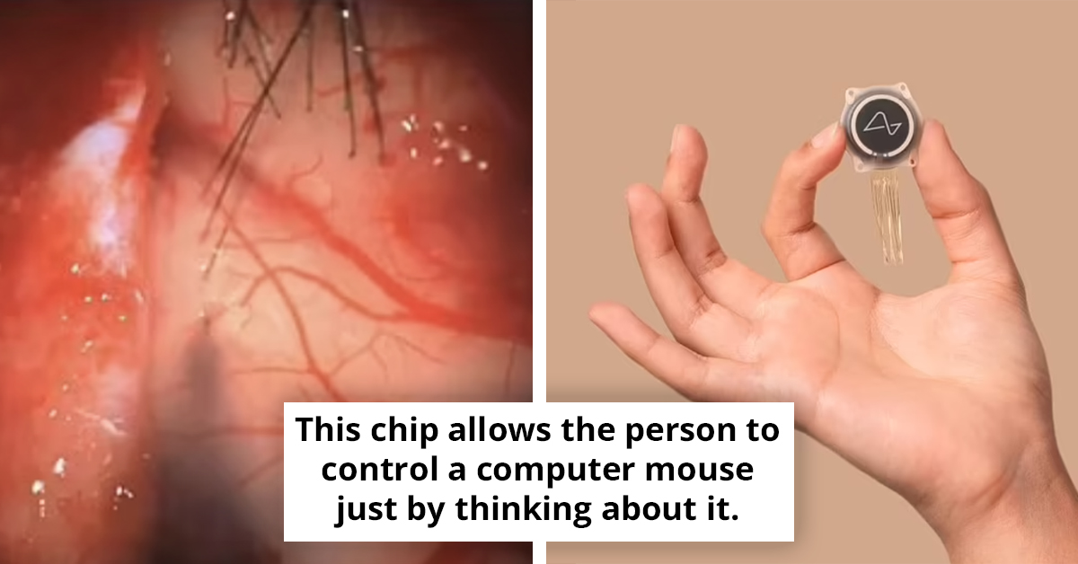 Elon Musk's Neuralink Makes Thought-Controlled Computing a Reality