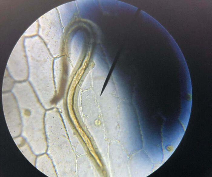 "Found This Worm On A Slice Of Onion In Biology Class; It Can Only Be Seen Under A Microscope"