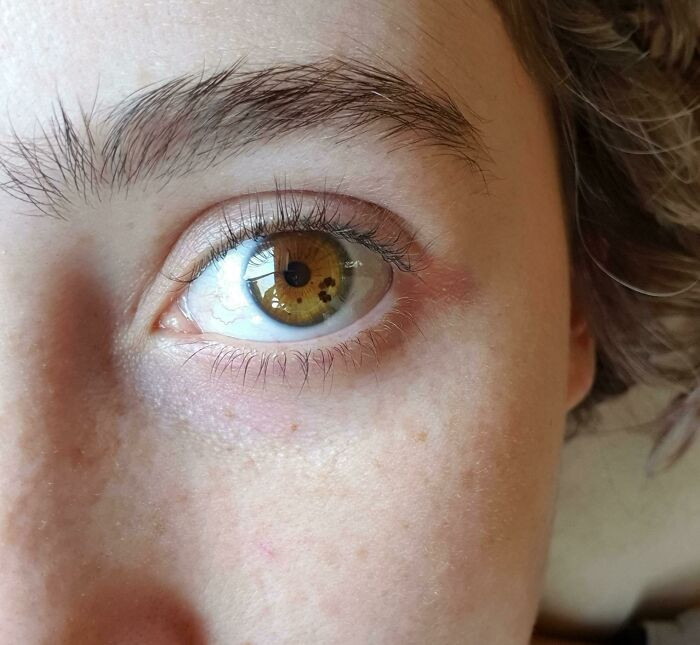 "The Freckles In My Eyes"