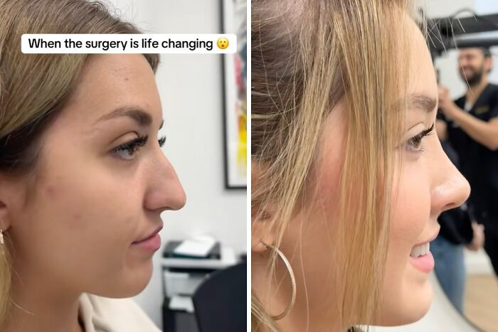 24. The cutest nose.