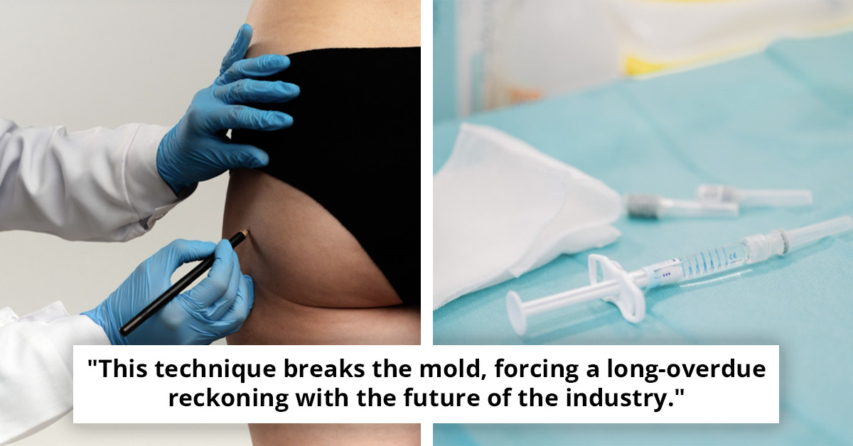 Physician discloses a trend of utilizing deceased individuals' fat for BBLs and breast enhancements