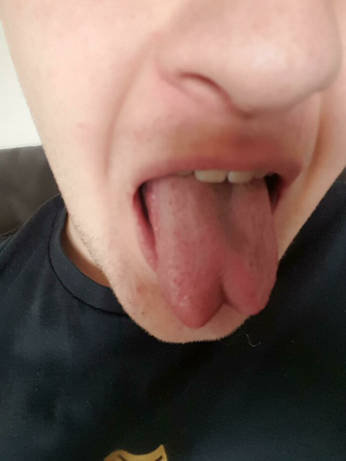 "My Tongue Is Naturally Forked"