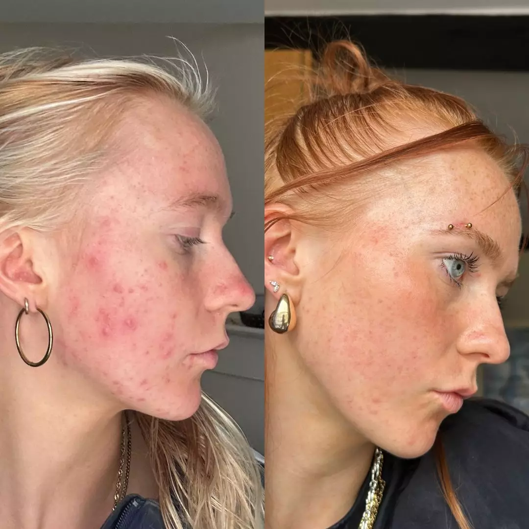 Thousands of customers have shared rave reviews online.