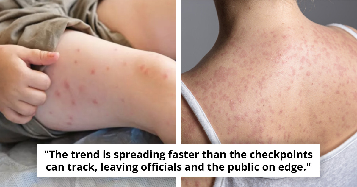 Newsworthy Update: Highly Infectious Illness Detected at Key American Airports