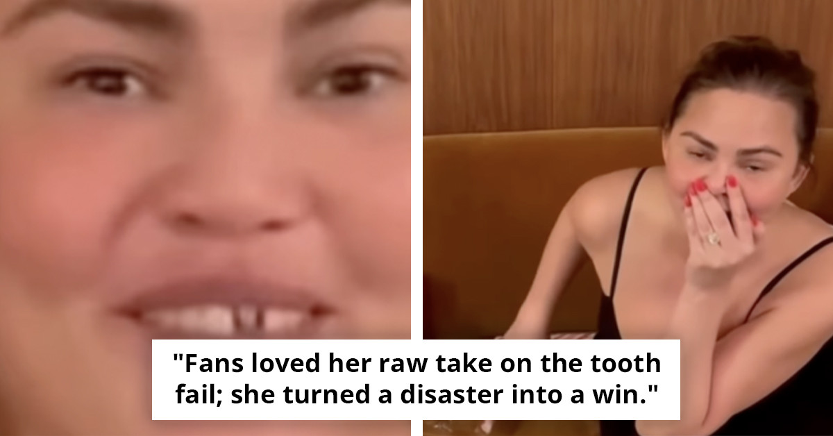 Chrissy Teigen's Front Tooth Mishap Caused by Candy Cane Blunder Sparks Surprise