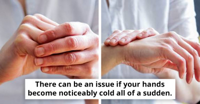 Five Subtle Signs On Your Hands That Could Point To Serious Health Issues, As Explained By A Doctor