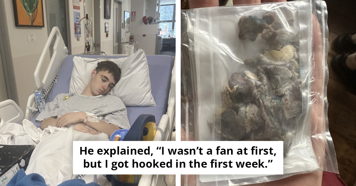 Shocking Image Reveals Damage to Teen's Lung from Excessive Vaping Over Three Years