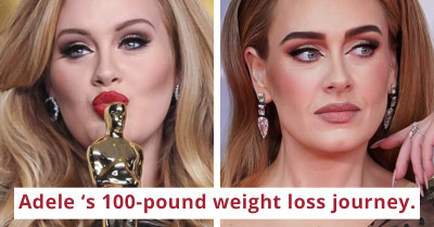 7 Celebrities Who Went Under The Knife and Recreated the Look We Know Today