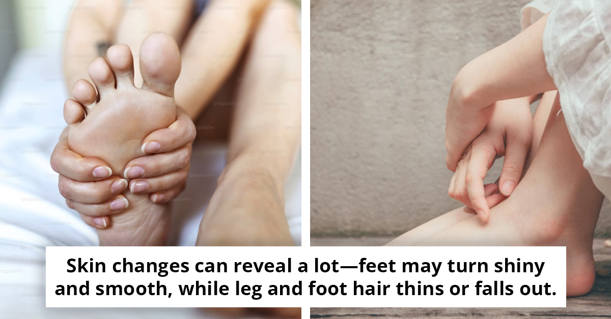 Pharmacist Warns Heel Pain Could Signal Serious Health Issue