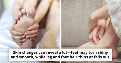 Pharmacist Warns Heel Pain Could Signal Serious Health Issue