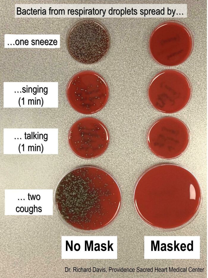 "A Doctor Sneezed, Sang, Talked & Coughed Toward An Agar Culture Plate With And Without A Mask"