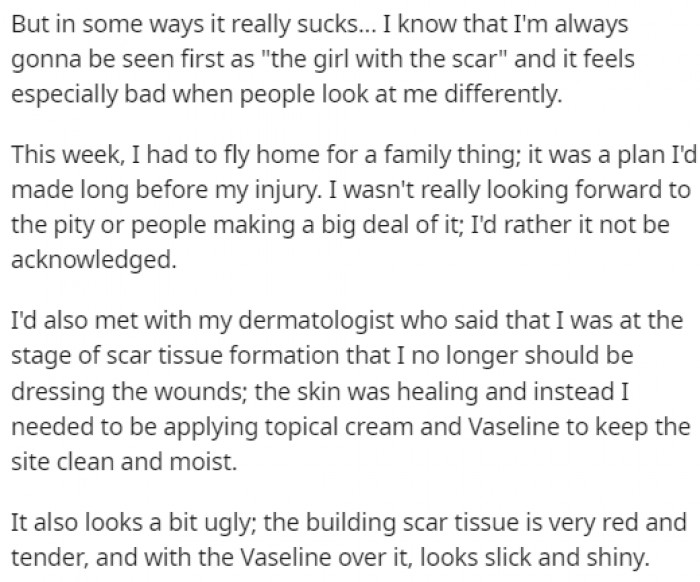 She didn't want the attention that people were bound to give her because of the injuries, but she had to catch a flight home.