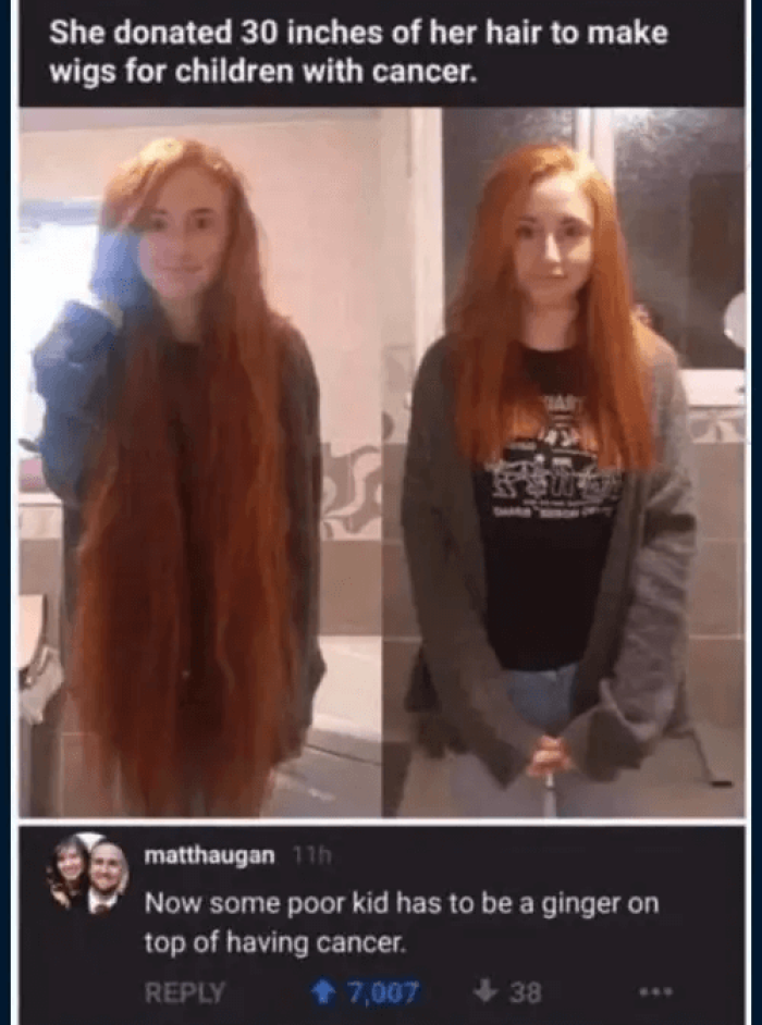 14. It’s better than no hair, isn’t it?