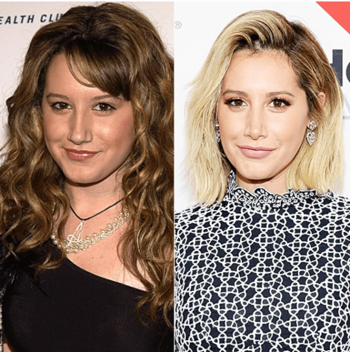 15. The “High School Musical” star Ashley Tisdale revealed that she had surgery in 2007 to treat a deviated septum.